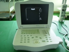 Escáner de ultrasonido totalmente digital para computadora portátil