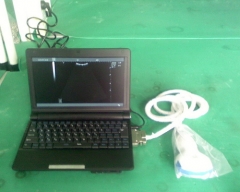 Escáner de ultrasonido digital para computadora portátil