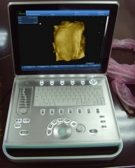 Escáner de ultrasonido portátil B portátil multilingüe basado en PC