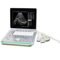 Escáner de ultrasonido portátil B portátil