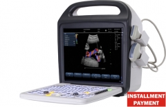 Escáner de ultrasonido Doppler color portátil