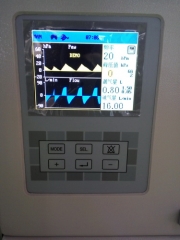 Máquina de anestesia con pantalla TFT de 5.7 pulgadas