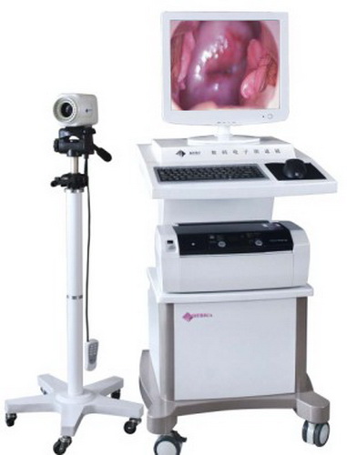 Colposcopio de vagina electrónico digital de 100.000 horas