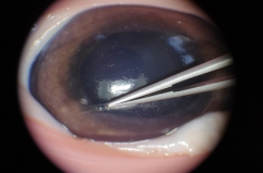 Simulador de entrenamiento de microcirugía de oftalmología, microscopio, instrumentos y modelo facial de silicona