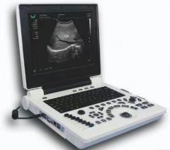 Escáner de ultrasonido portátil (software 3D)