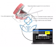 Sistema Imagine de rayos X intraorales digitales ( FDA CE )